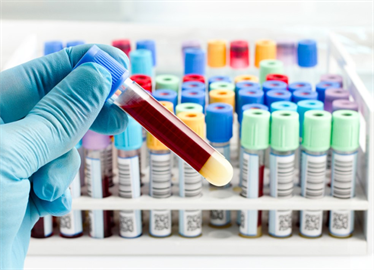 standardized fast lowflow lcms