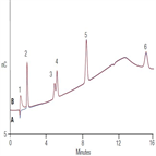 carbohydrates urine