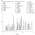 an107 ions anions physiological fluids