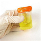 forensic screening for drugs urine using highresolution msms spectra simplified highperformance screening software